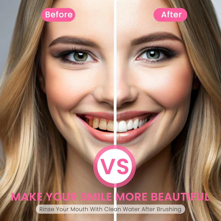 š„šćMaxćTLOPAĀ® Nicotinamide ToothpastećšNew upgrade Powerful type 10% concentration of Nicotinamideć