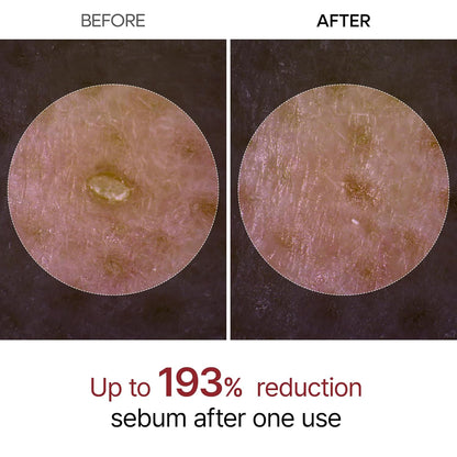 Final 3 Hours: 60% OFF🔥 Gentle Exfoliator Glow Rice Ampoule-Suitable for All Skin Types