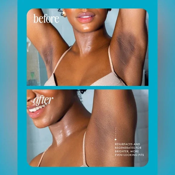 🔥⚡️ 5-Second Post-Hair Removal Rescue: Bumps Fade, Skin Glows! Glass Smooth Oil.